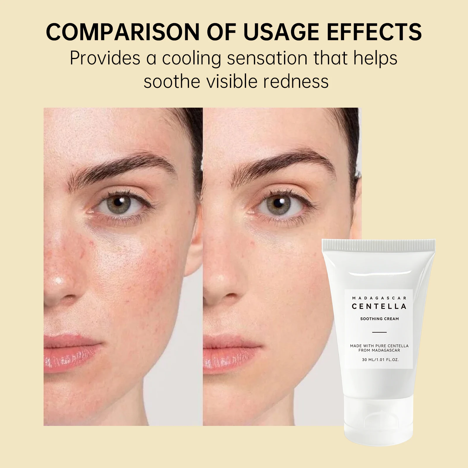 Успокаивающий гель с центеллой – обзор и цена Skincare Centella