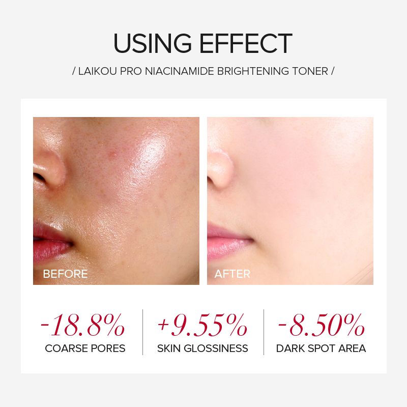 Набор для ухода за кожей LAIKO – обзор и цена Skincare Oily Skin