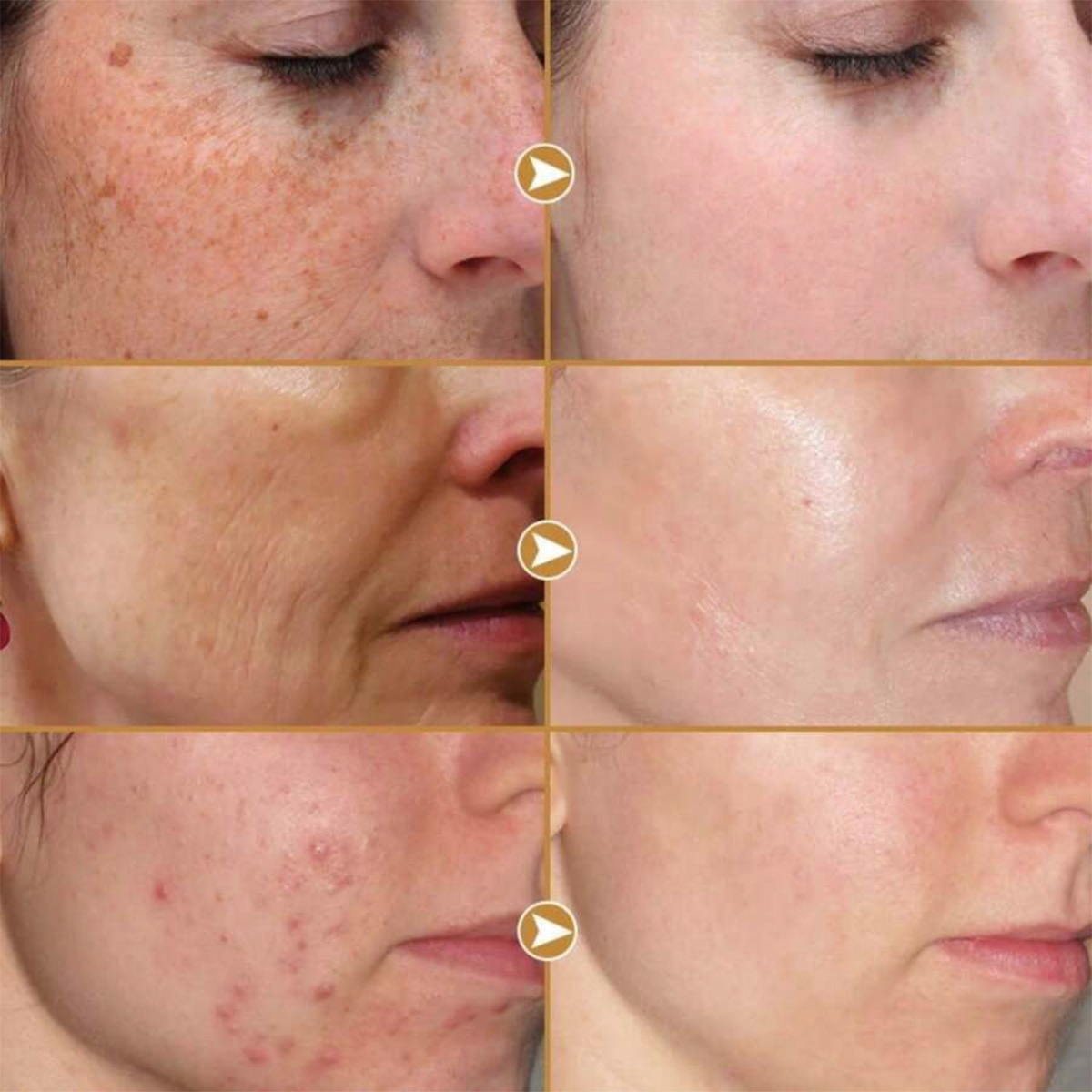 TRSTAY Peptide Compound Essenc – обзор и цена Peptide Neck Cream